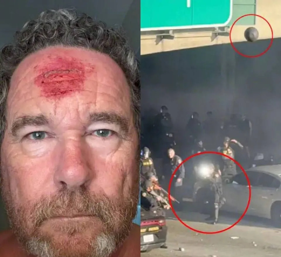 记者美国采访，被警察橡皮弹爆头











这事儿听着就让人来气！一个