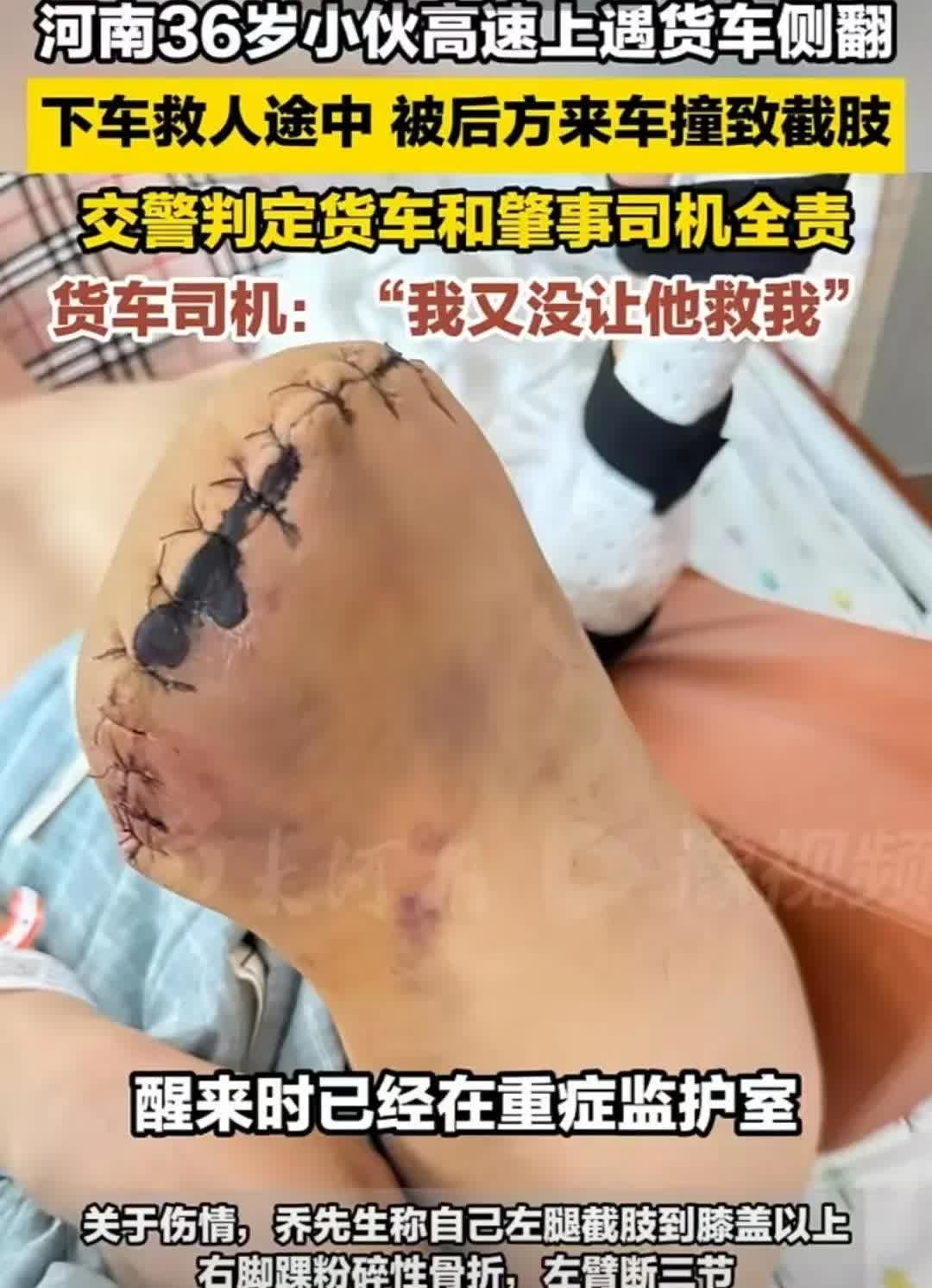 轻易不要介入别人的因果，这句话的含金量还在上升。

河南36岁男子乔某，凌晨
