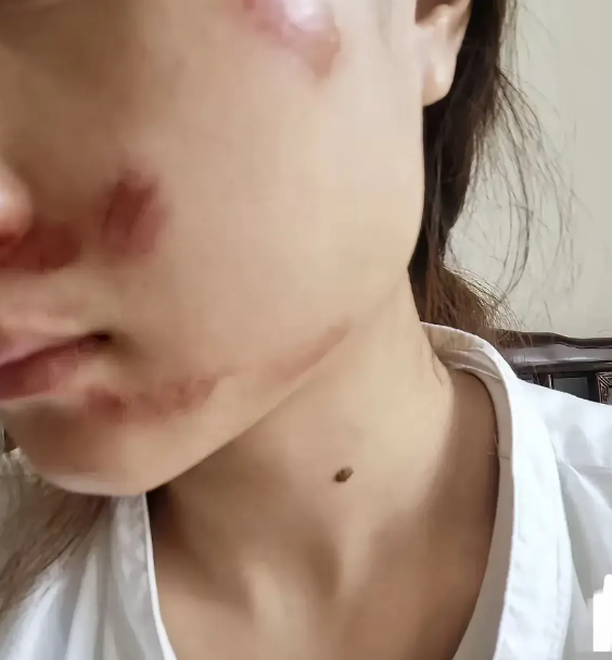 孩子被打了，打人孩子和家长一点责任都没有，不仅不道歉，还理直气壮，孩子自找的，孩