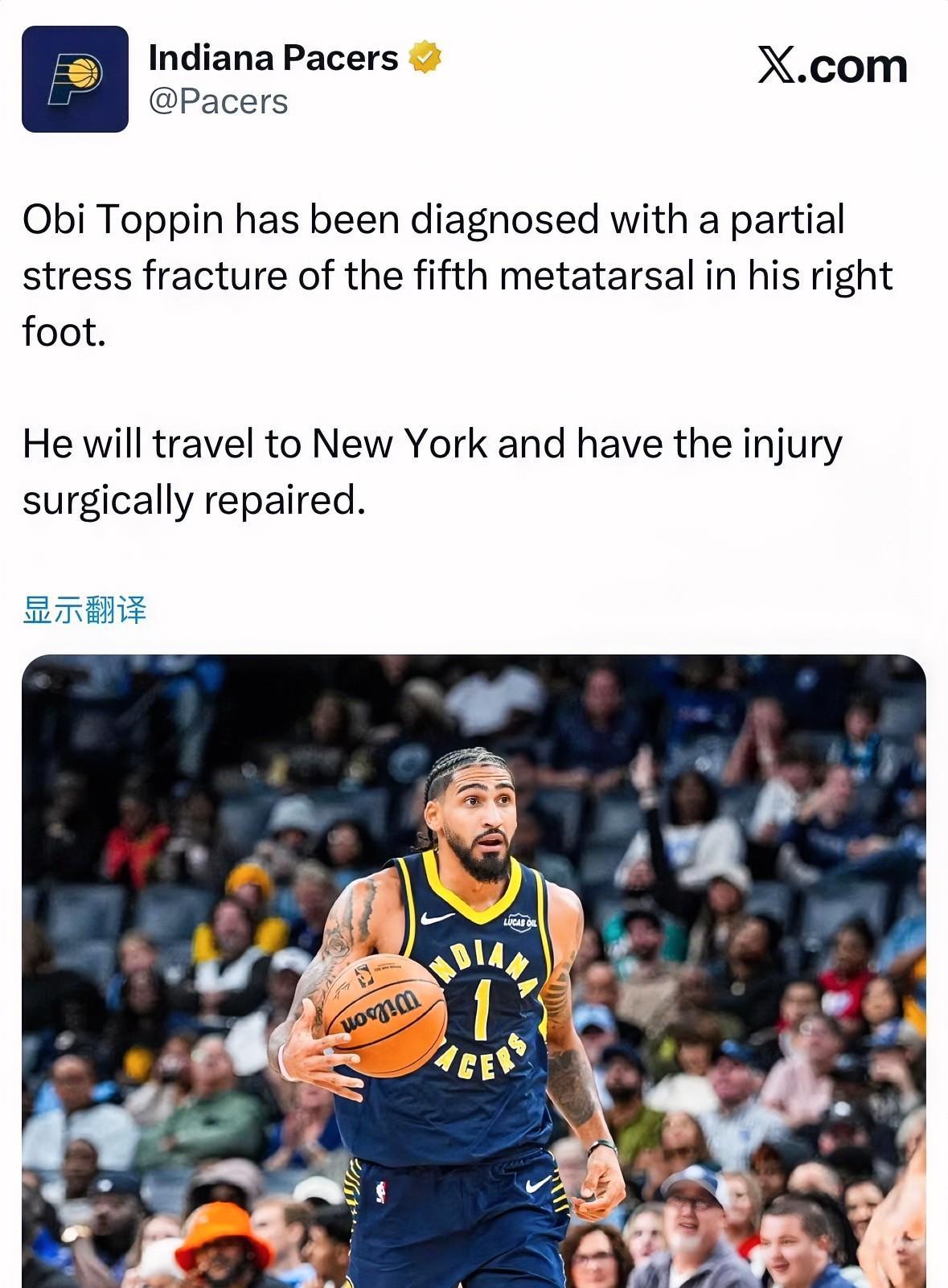 步行者再伤一员大将，预计缺席3个月！
据步行者官方报道：奥比托平被诊断为右脚第五