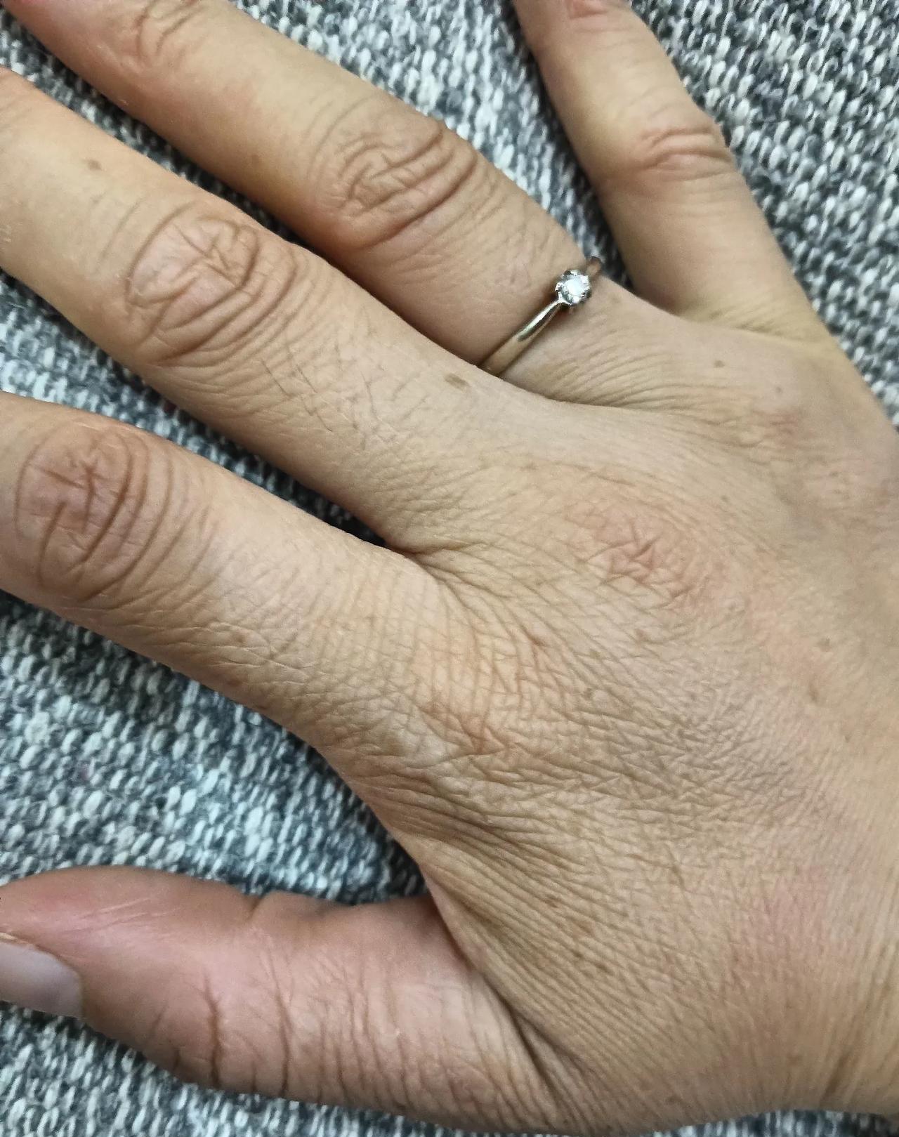 都说手是女人的第二张脸，给大家看看我的手吧！可能大家都能想到我现在的脸已成什么样