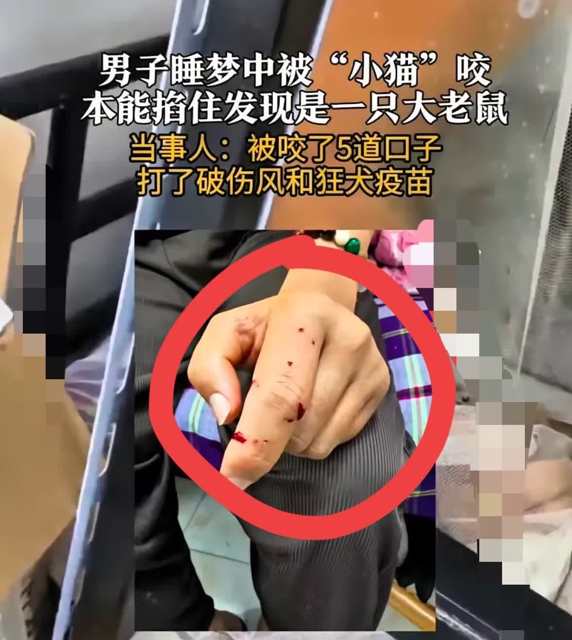 救命！谁懂啊！“太悲剧了！”

江苏无锡一男子大半夜睡觉，感觉手上有东西在动