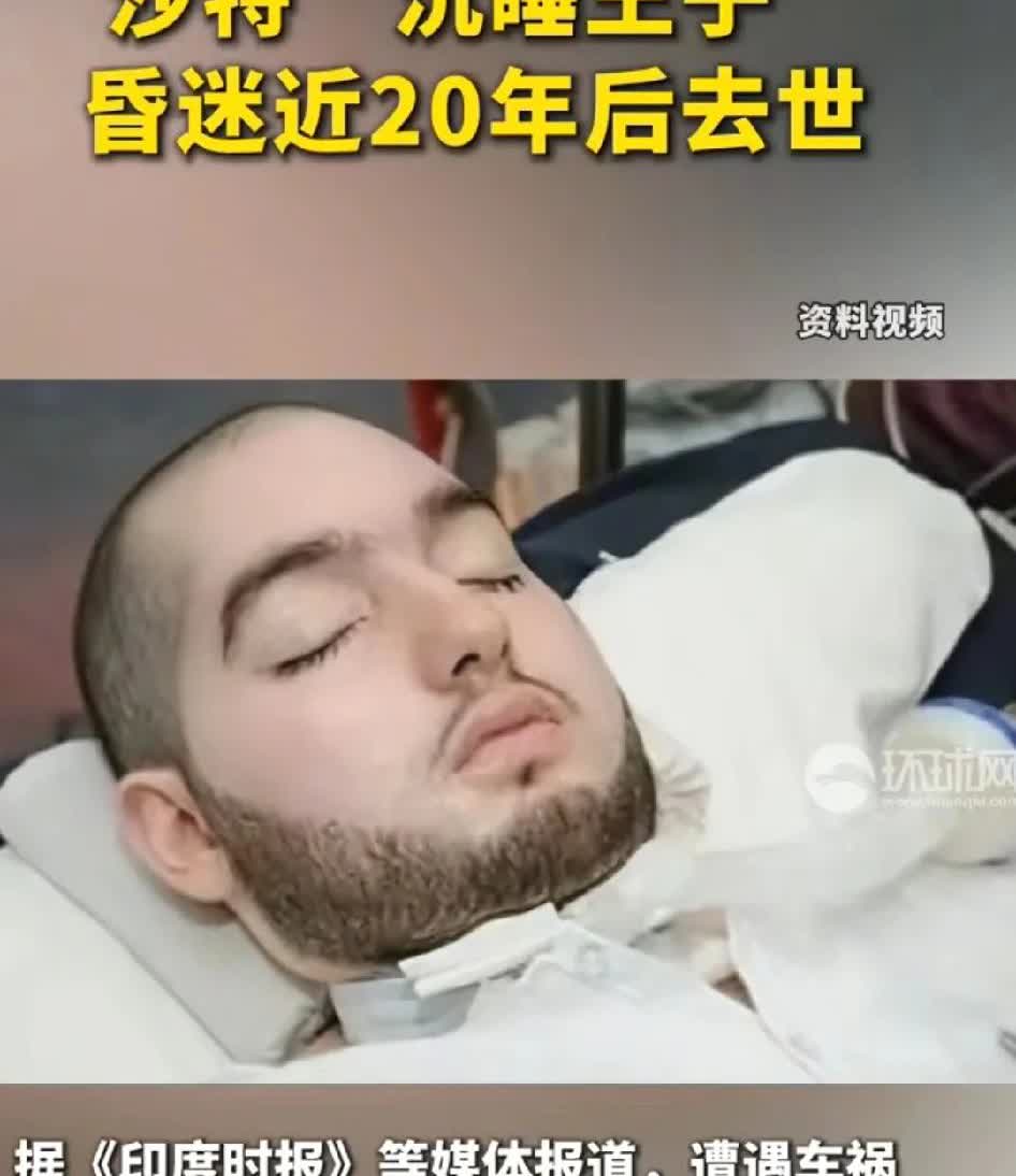 因车祸昏迷20年的“沉睡王子”，沙特王子阿勒瓦利德去世，要是用中医针灸也许早都康