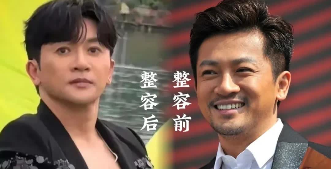 苏有朋整容前后的对比，让人觉得自然地老去才是最帅的！以前的苏有朋能够笑得无比阳光