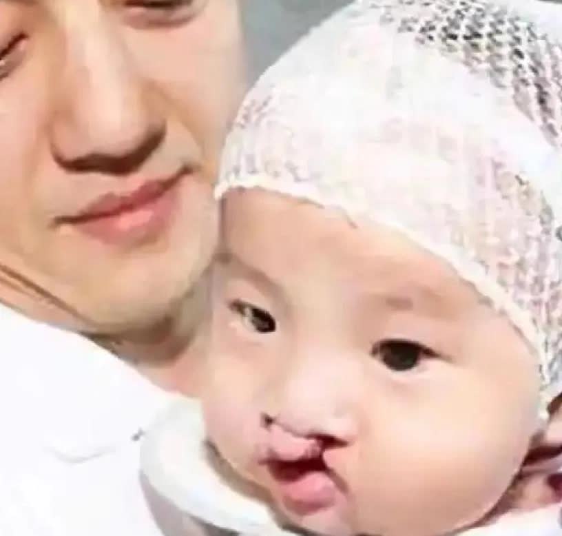 王菲女儿李嫣终于熬出头！18年修复路，如今模样大变认不出？