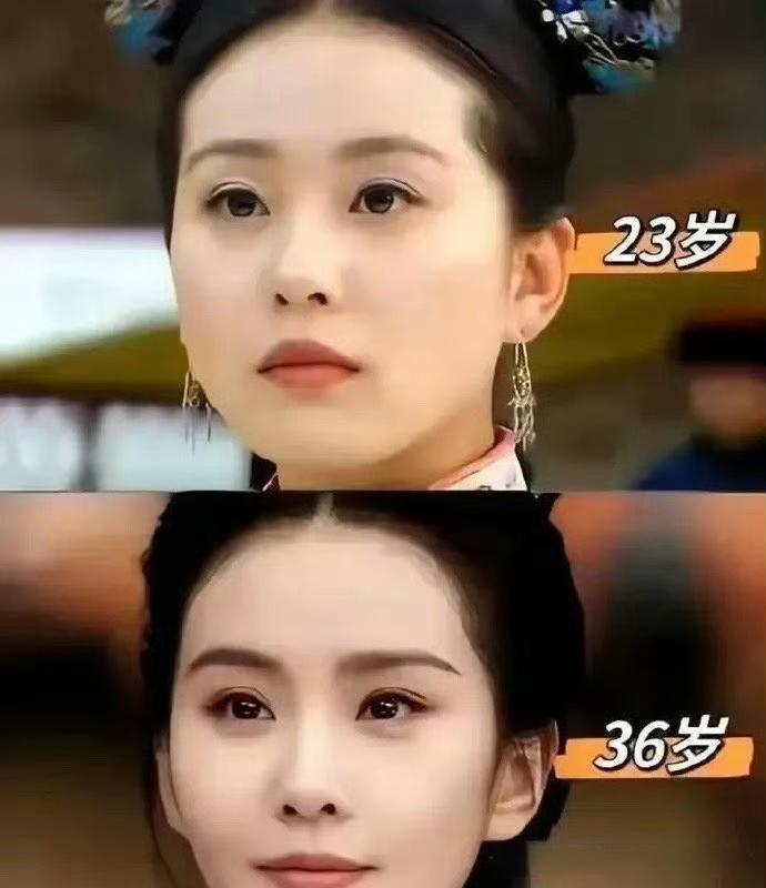 随着年龄增长，不论男女，嘴唇都会逐渐变薄，明星也不例外