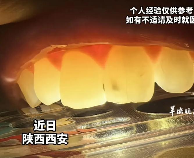 救命！西安女子深夜牙齿阵痛，翻来覆去找不到病灶。身为牙医的男友灵机一动，直接把手