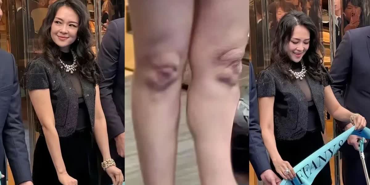 汪峰女友腿上淤青真相

全网独家，马上删

章子怡、森林北腿上常年青一块