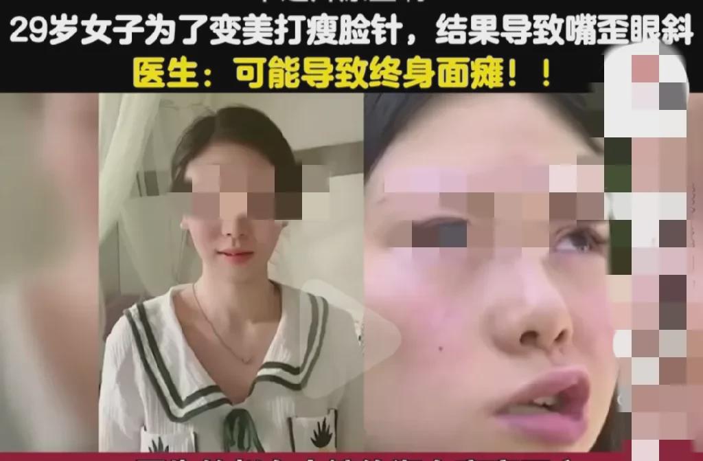 浙江杭州，女子花了4000元，在美容院打了两针瘦脸针，结果脸歪了，这可咋整？  