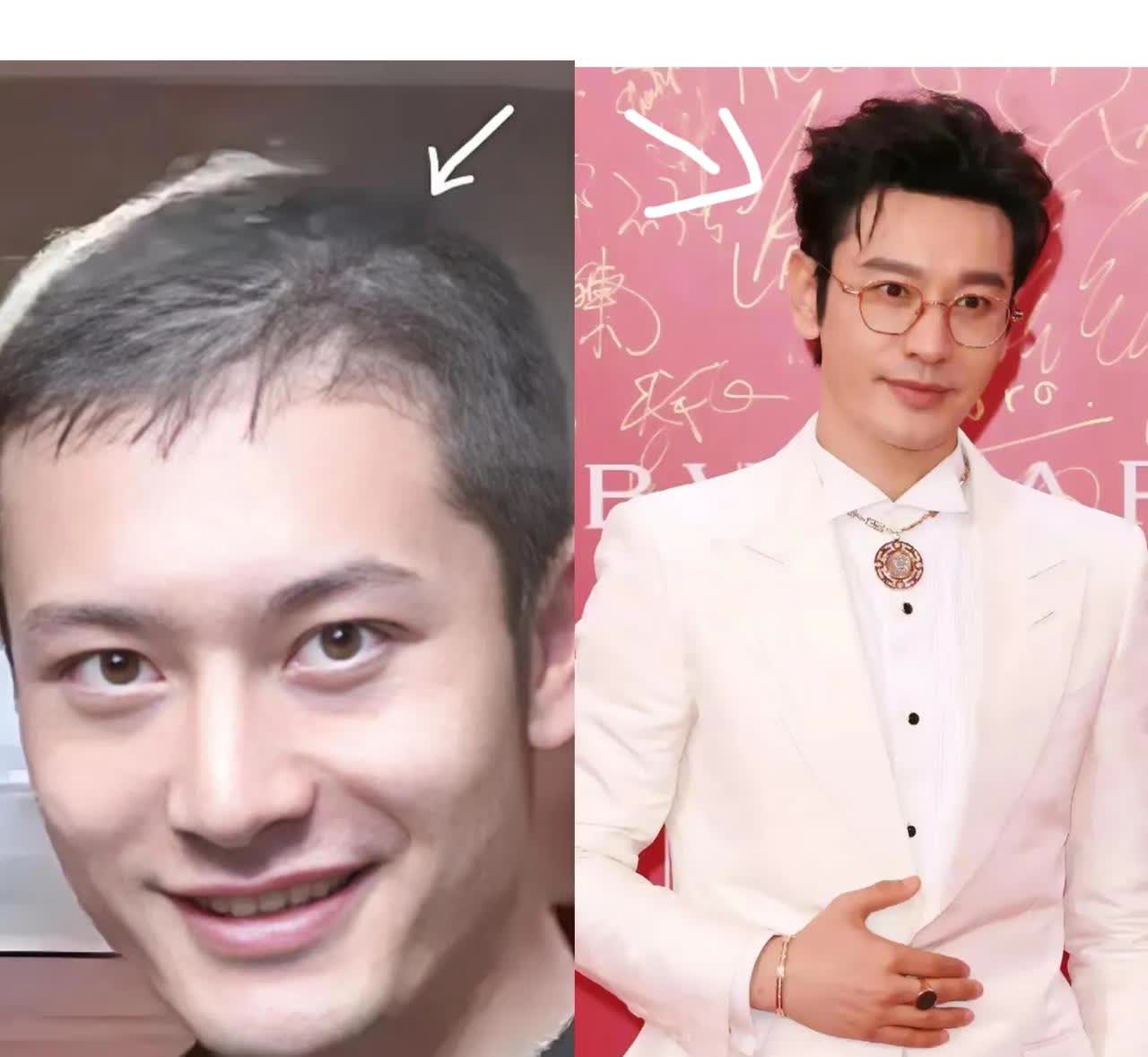 一觉醒来，黄晓明的天塌了
不是叶珂又给他挖坑，也不是他的英文口语又被网友吐槽，