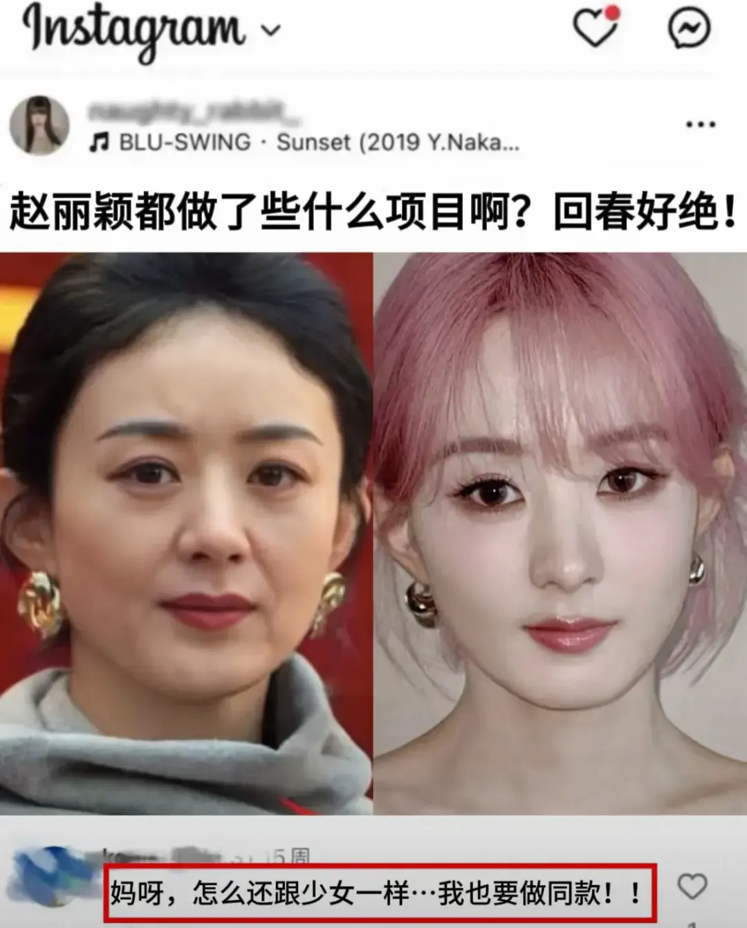 快40岁的赵丽颖显老了吗？
