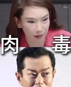 戚薇这个吊眼，让我想起了古天乐！
戚薇这个姑娘就是实诚，承认自己眼睛就是做了皮肤