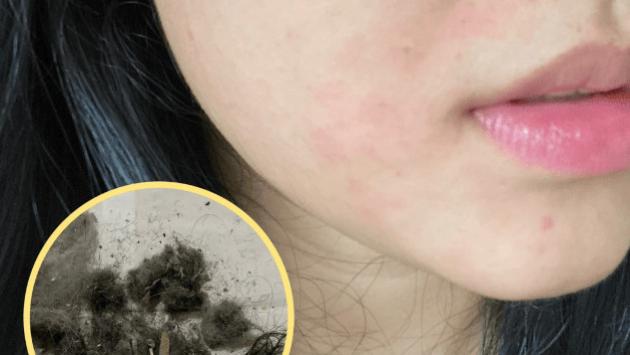 除螨仪哪家比较好？家用除螨仪多大功率合适？十大高口碑除螨仪品牌排行榜！独家测评放送！