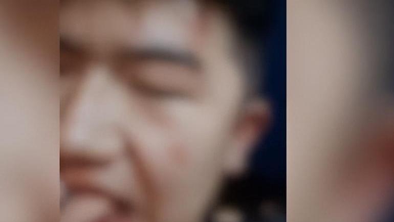 一条未拴绳的狗突然窜出，女司机避让不及撞到狗，同车男子遭狗主人亲友围殴致伤