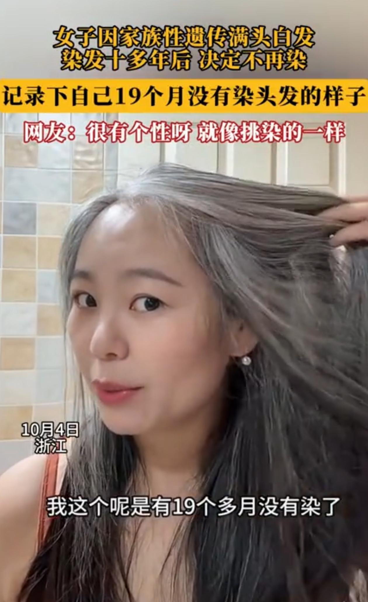 “没招了！”浙江，女子年轻时就一头白发，她坚持染了十多年，如今人快40了，实在挺