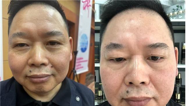 徐东升：从“头”开始，触摸美丽的温度