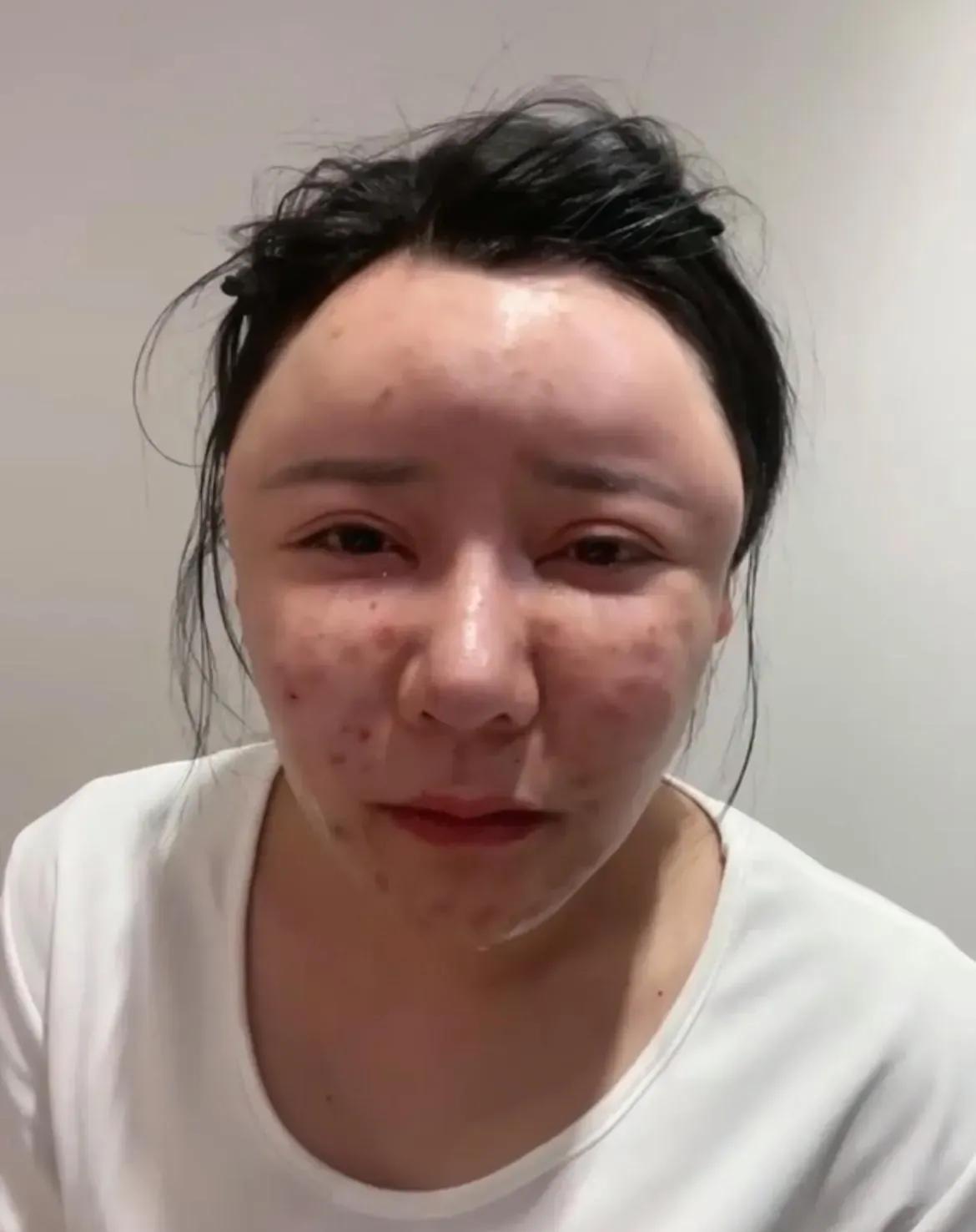 三十多岁正是朝气蓬勃的时期，应该自然美最好，不要进行美容。
像这个女孩，只有三十