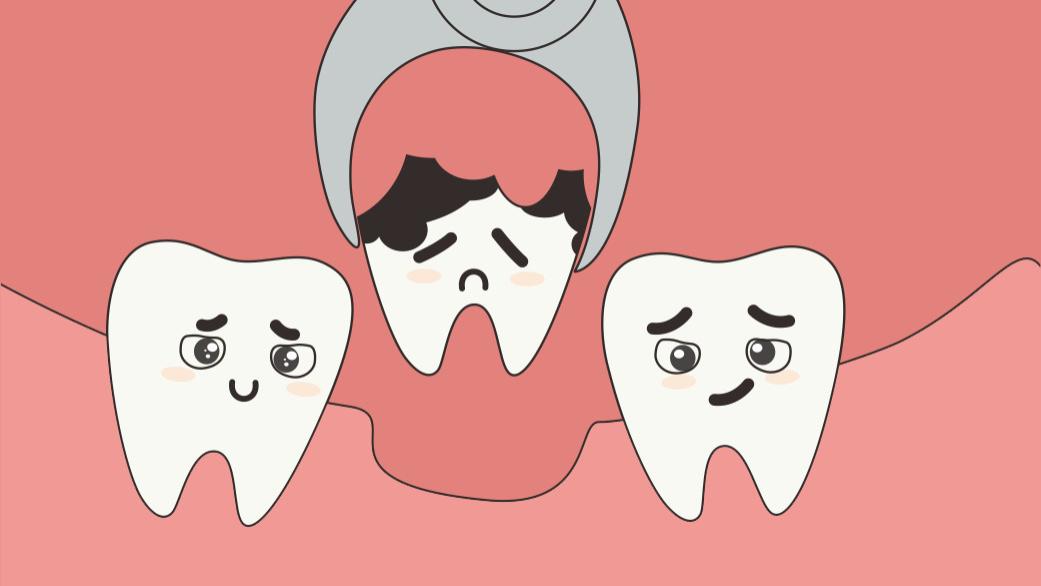 拔牙后装假牙，不是等越久越好！牙医揭秘3种修复方案时间表