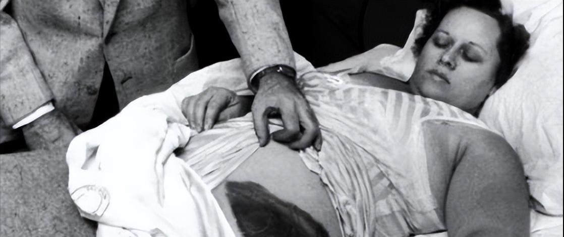 1954年，国外一女子睡觉时，感觉腹部被什么蹭了一下，醒来发现身边有块黑乎乎的石