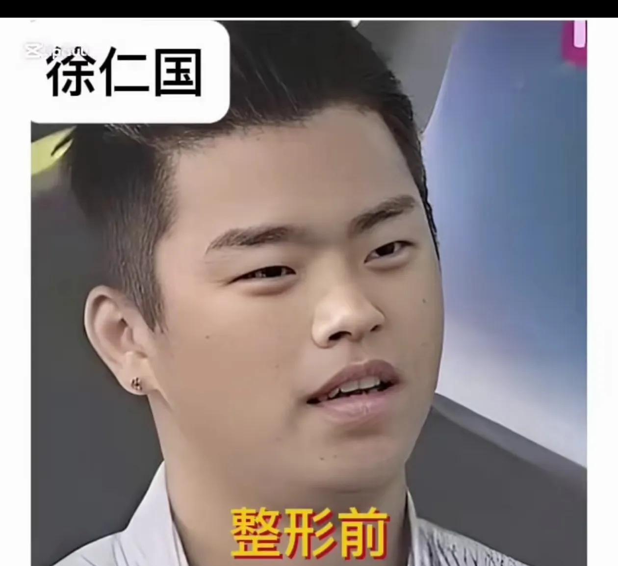 来看看你们滴欧巴整容前后对比吧！
不得不说颜值的上限看脸型鼻子呀！眼睛不太丑就可