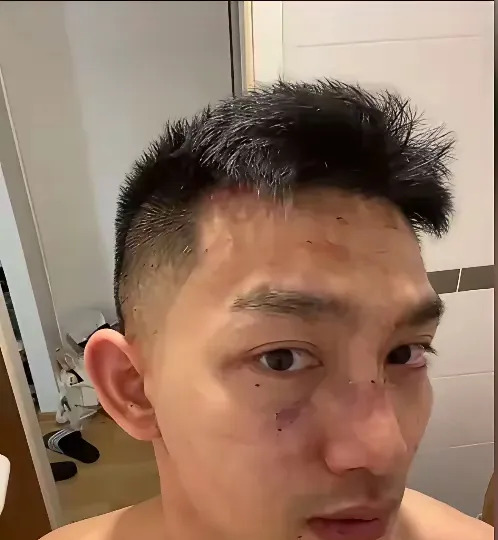 留学生怒砸手机反击歧视











不可思议！一名中国留学生在德国竟被