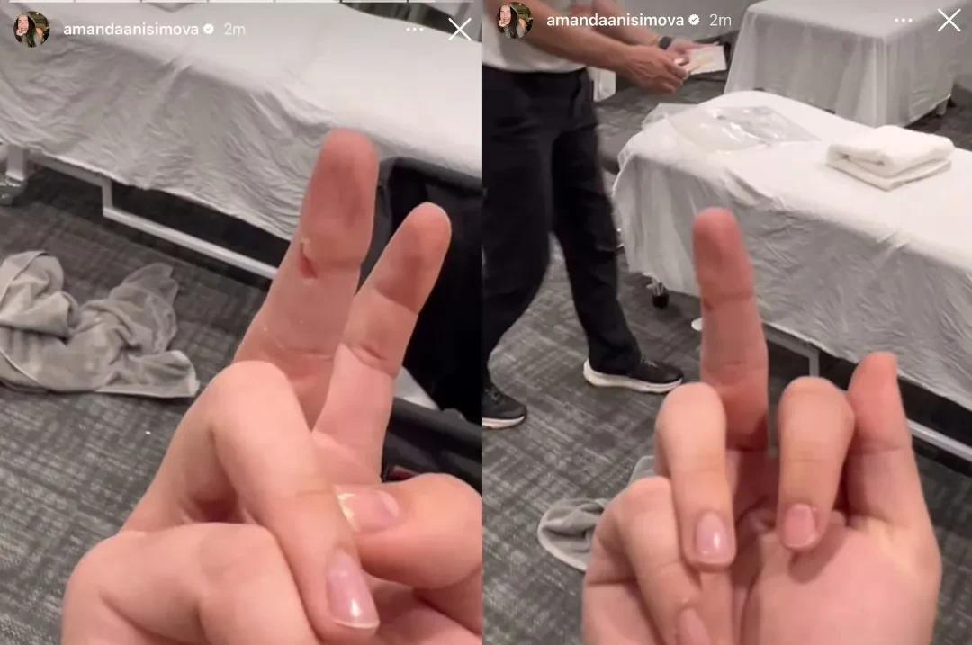 阿尼西莫娃发文竖中指疑似暗讽安德烈耶娃！今天在迈阿密网球公开赛女单第三轮比赛中，