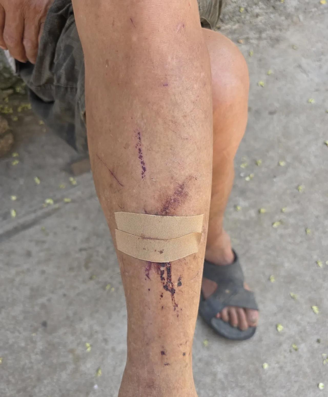 瘆人：我们觉得要命的事，父老乡亲看来不足挂齿……
今天上午在北京情报站，跟这里的