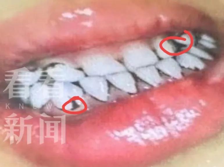 甘肃天水平息幼儿园铅中毒事件努力方向错了
目前最大问题就在于幼儿园患者家属对天水