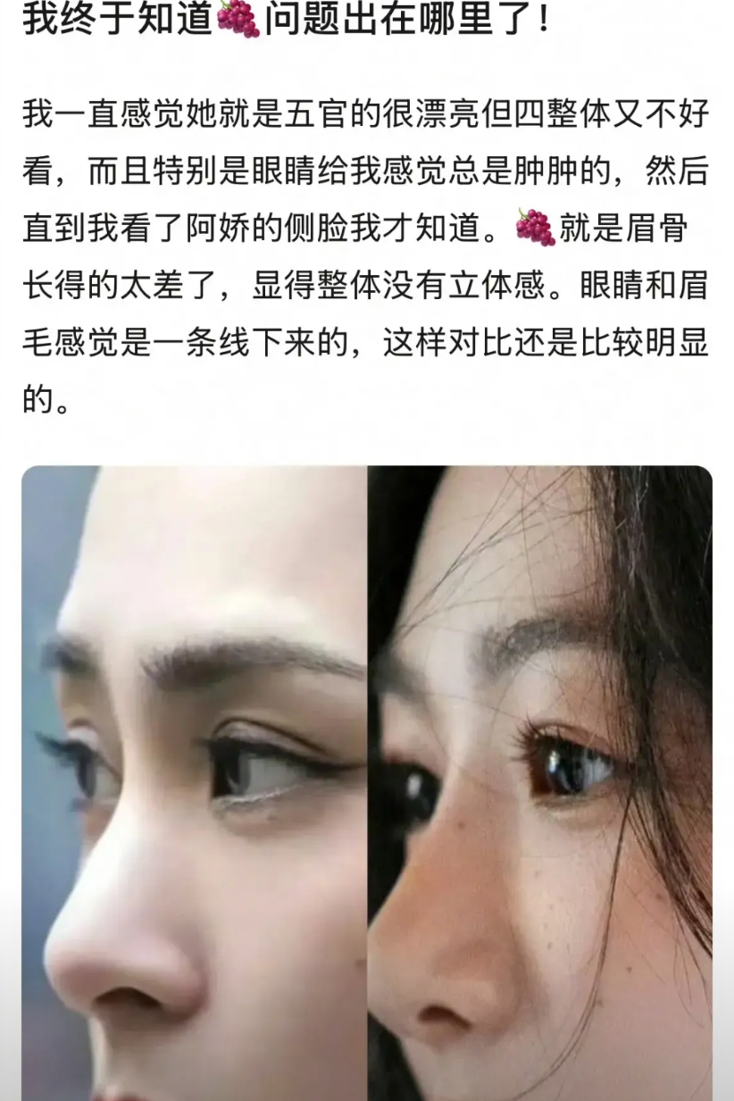 杨紫主要就是骨相不好，除了眼睛还算好看，脸上其他部位都长得一般般，这是在《家有儿