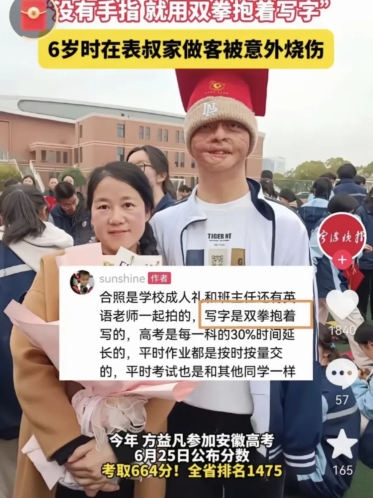 这大概就是老师经常说的“身残志坚”的最好诠释了吧！
烧伤男孩方益凡高考664分