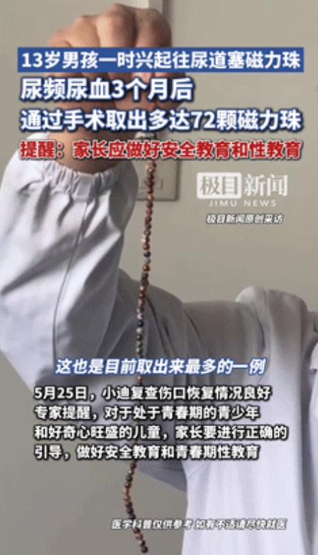 “无敌了！”武汉，13岁男孩往尿道塞入72颗磁力珠，因担心父母责怪，竟尝试用“钓