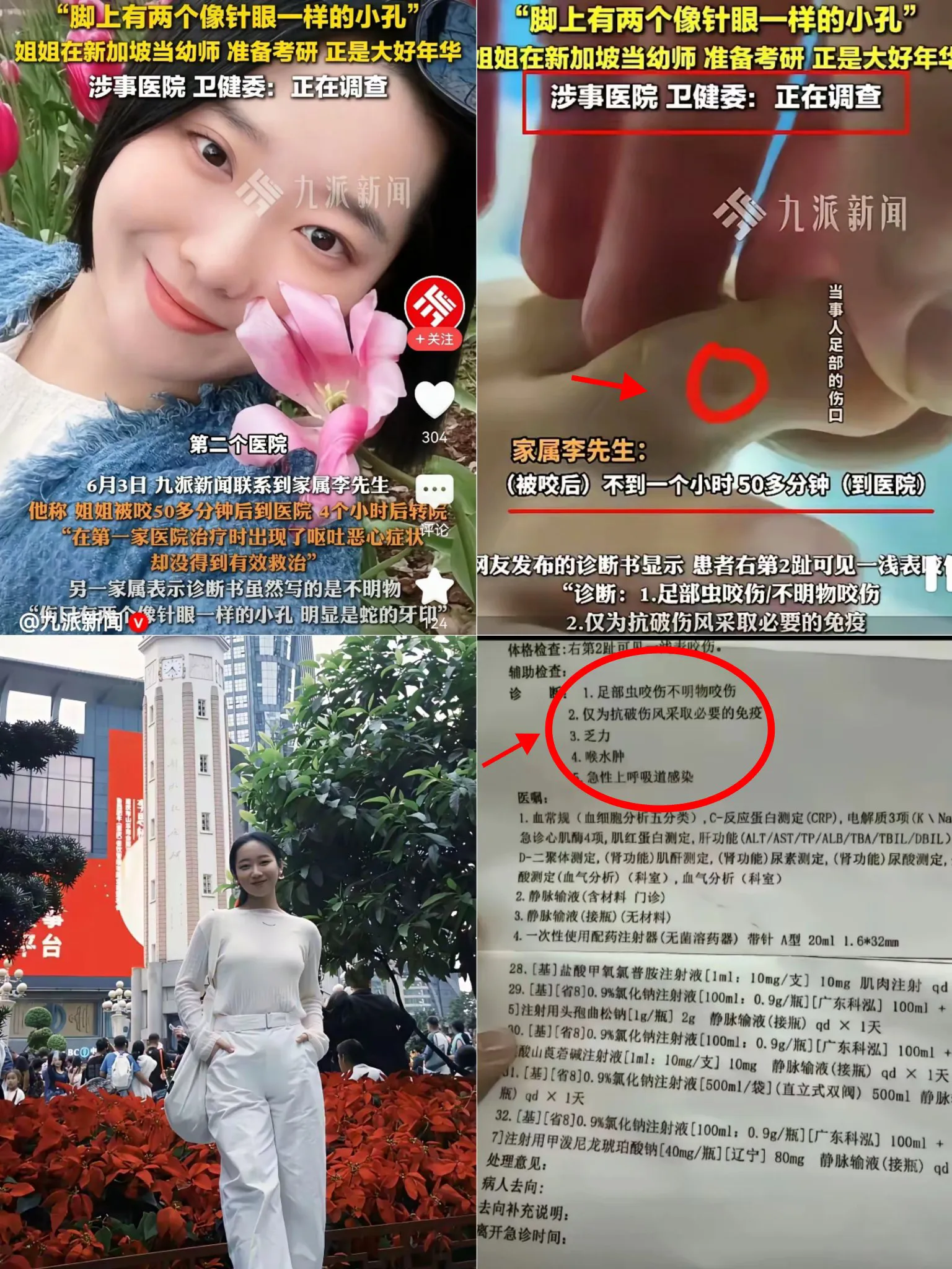 被毒蛇咬亡女子最新后续来了！男友说出更多细节，真的太让人心痛了！
 
男友张鹏回