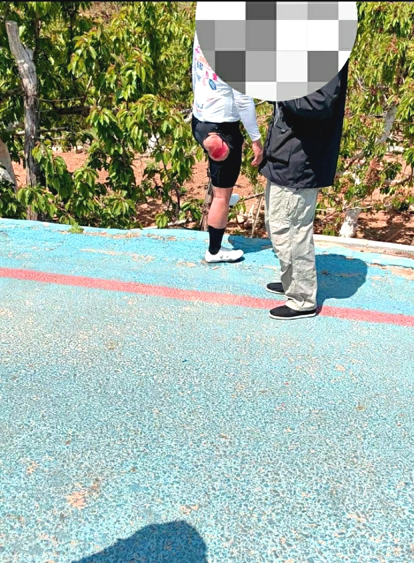 幸亏是磨的屁股，要是磨的前面就完了