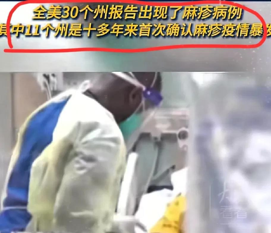 美国麻疹大爆发，这事儿闹大了











美国麻疹大爆发，简直让人没法