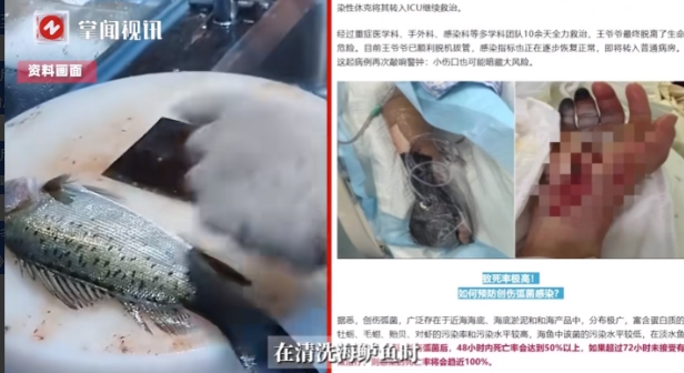 这下后悔了吧！”近日，浙江绍兴，一位88岁的大爷在家里清洗海鲈鱼时，右手手指不小