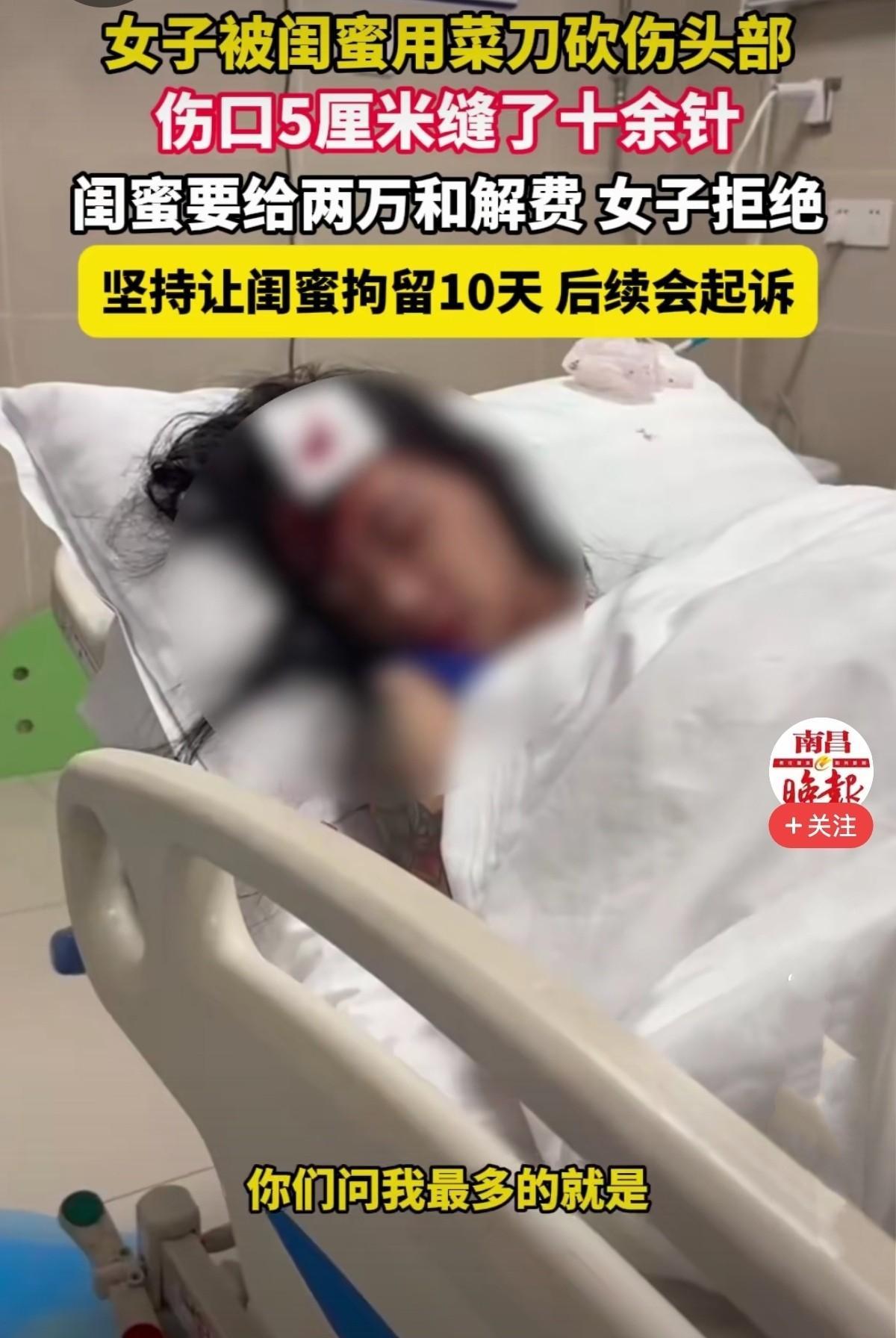 重庆，女子请闺蜜喝酒，酒后闺蜜跑到她家与她争吵，情绪激动，拿起菜刀砍伤她头部，到