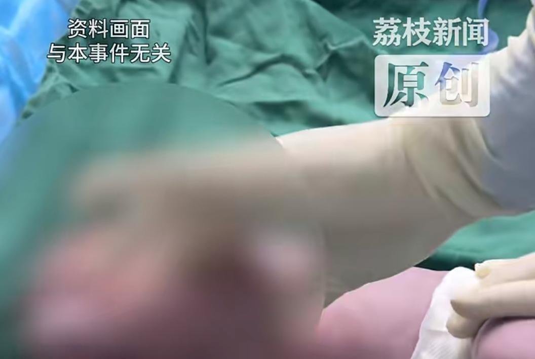 【网友质疑医生暴力接生致婴儿残疾 当地卫健局回应】
近日，广西富川，有网友反映“