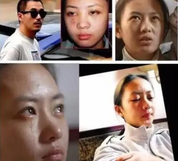 2003年，张国立的儿子张默在中央戏剧学院门口，动手打了他女朋友童瑶。当时18岁