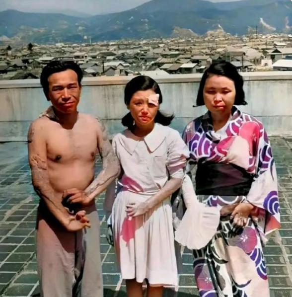 历史影像定格的血色真相：

这张泛黄照片被百万网友痛骂"活该"，画面中浑身溃烂的