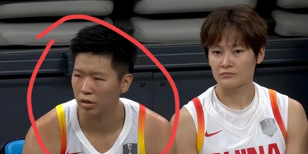 原以为打小日本随便打，特别是又有内线巨无霸张子宇，没想到啪啪打脸！[打脸][打脸