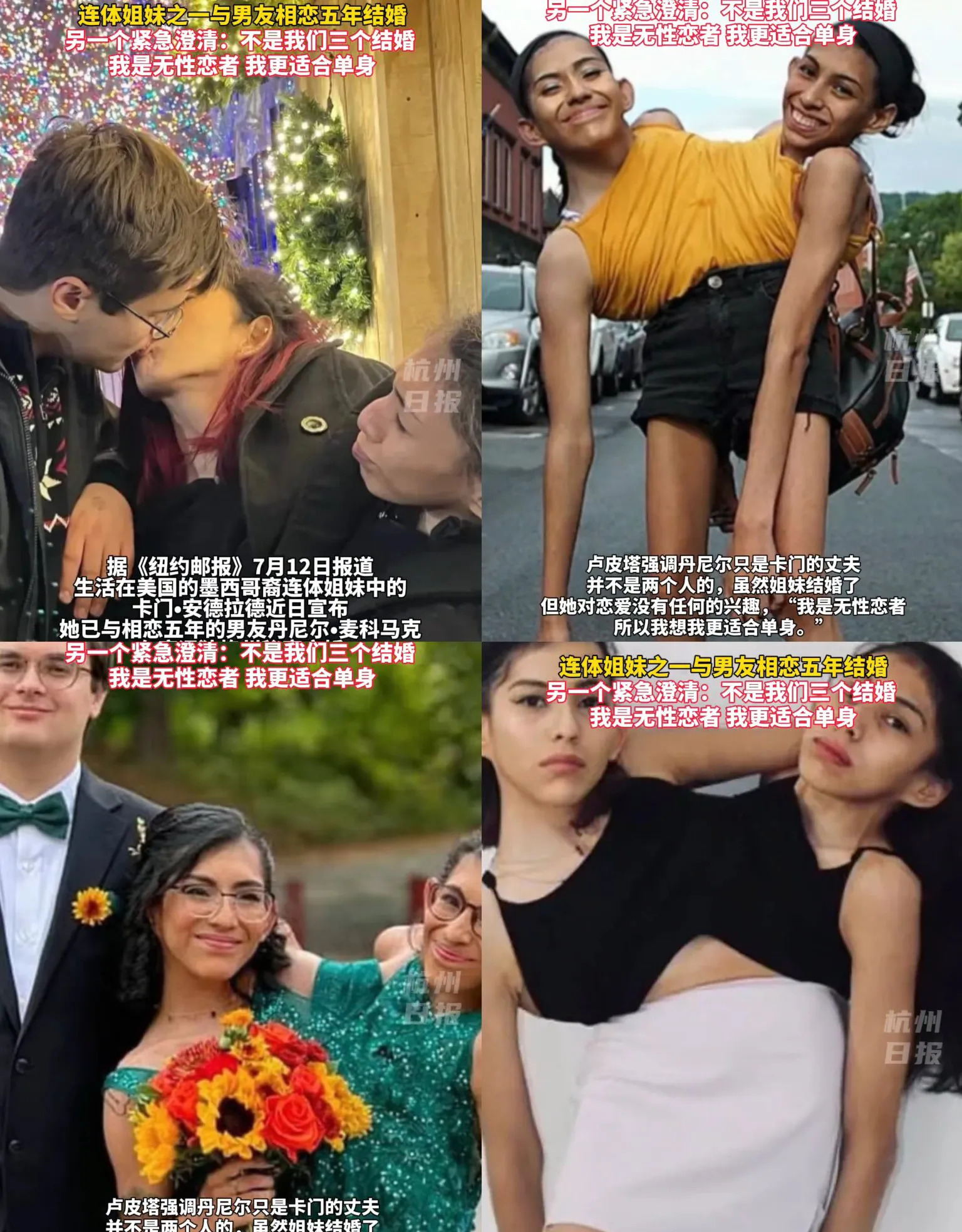 连体姐妹结婚，同房咋办？











天呐！连体姐妹竟然结婚了！这可不