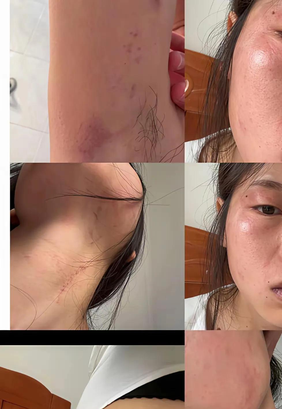 我老公爱喝酒，喝完酒就对我拳打脚踢。



那天夜里，他又喝醉了，再次对我又打又