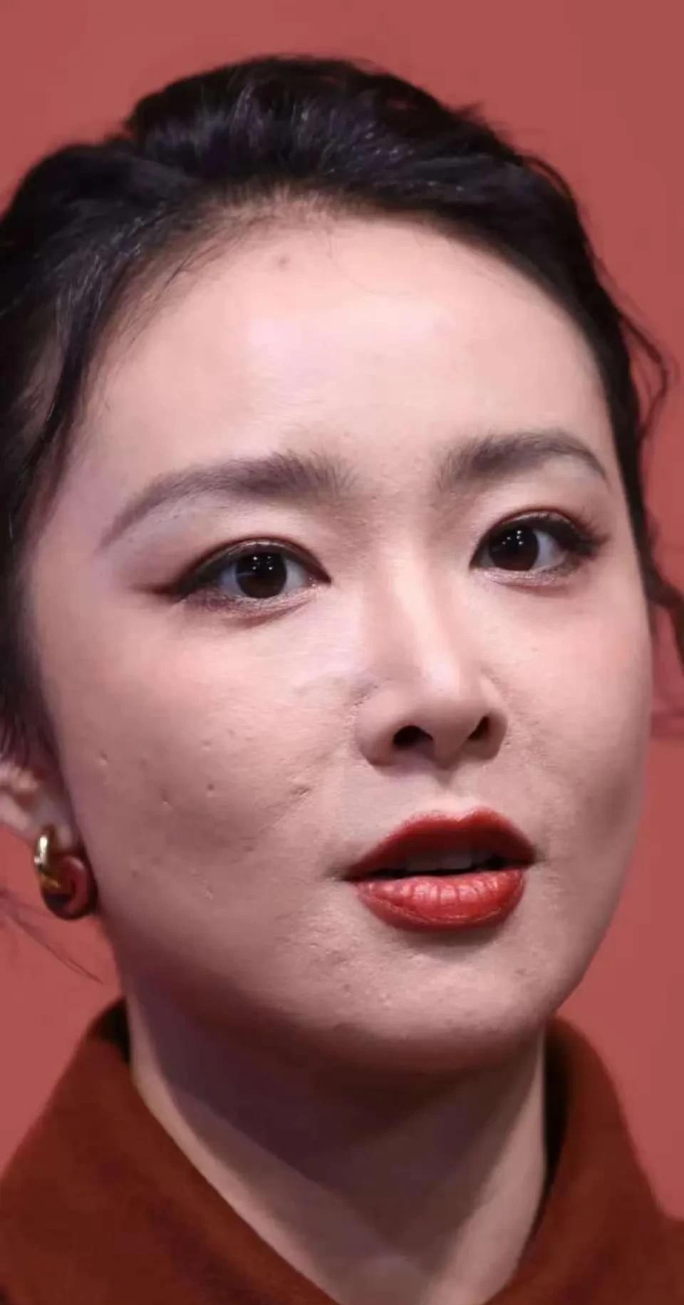 原来这就是大嫂高叶真实的皮肤状态这坑坑洼洼的是不是很吓人。
明星对皮肤的要求不应