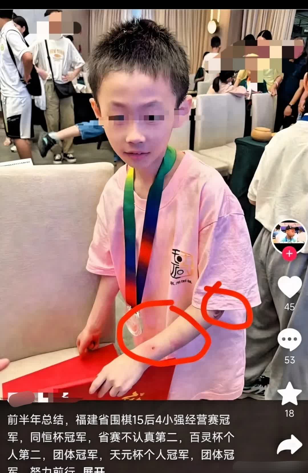痛心，天才少年一跃而下！

围棋天才朱宏鑫，

19号晚上从楼上跳下，为