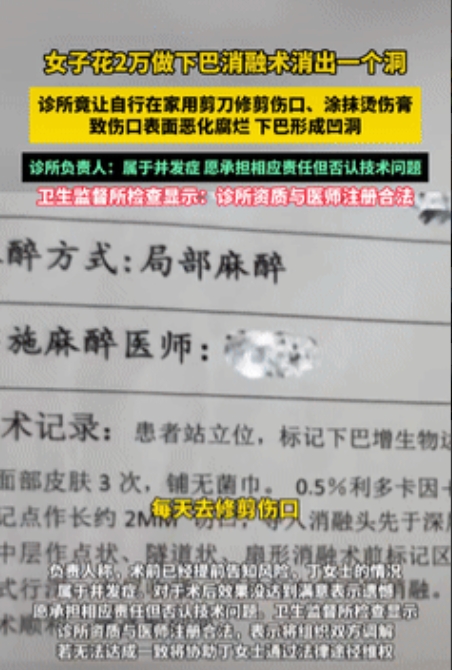 花钱买罪受！江苏，一女子很爱美，就花了20000块在美容诊所做了“下巴消融术”，