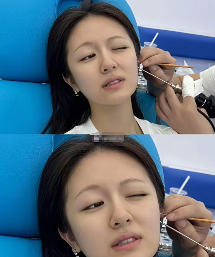 我丢...李兰迪这素颜。。 ​​​