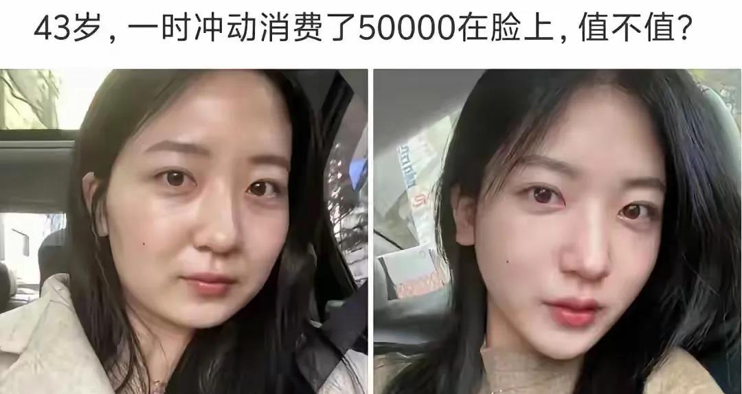 大家说这整容值不值得