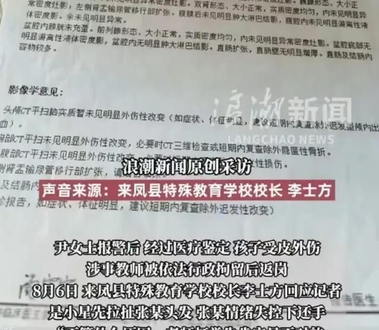 湖北恩施，女子将17岁的自闭症儿子，送往特殊学校，结果儿子被打伤，她说，她的儿子