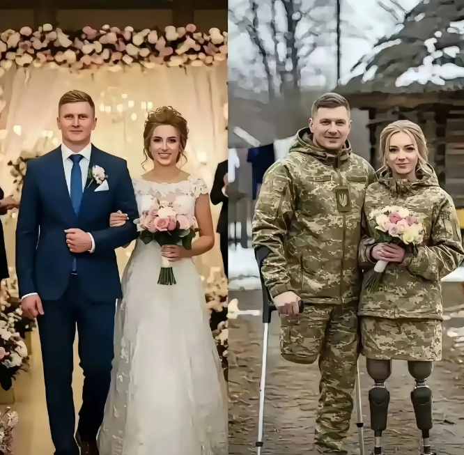 乌克兰的一对夫妻，一段被战争改写了的人生，命运的齿轮在他们残缺不全的这一刻，就已
