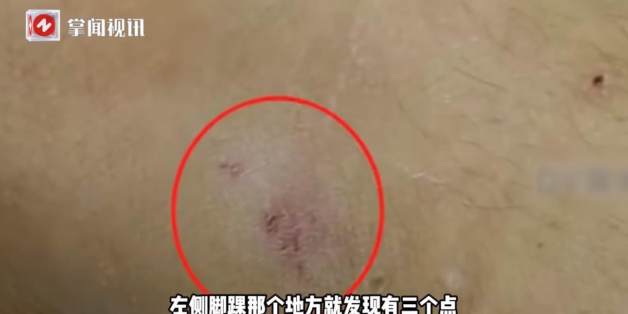 “这都是命啊！”近日，广东韶关，一8岁孩子在和母亲经过小水沟时，不小心摔了一跤，
